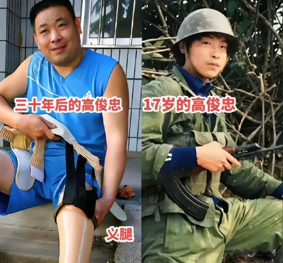 1985年1月，17岁的高俊忠随济南军区某部“双大功七连”前往云南老山前线。在攻