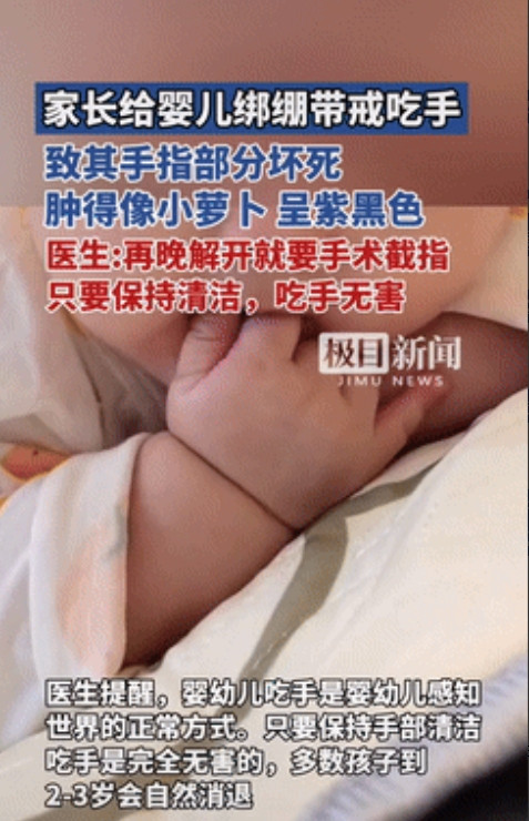 都是无知惹得祸！湖南一女婴因喜欢吃手指，家长认为不卫生，就用弹力带绑住她的右手，