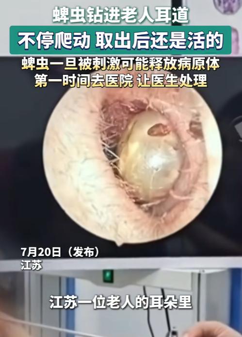 头皮发麻！7月20日报道，江苏一位老人总觉得耳朵里不对劲，到医院一查，医生都吓了