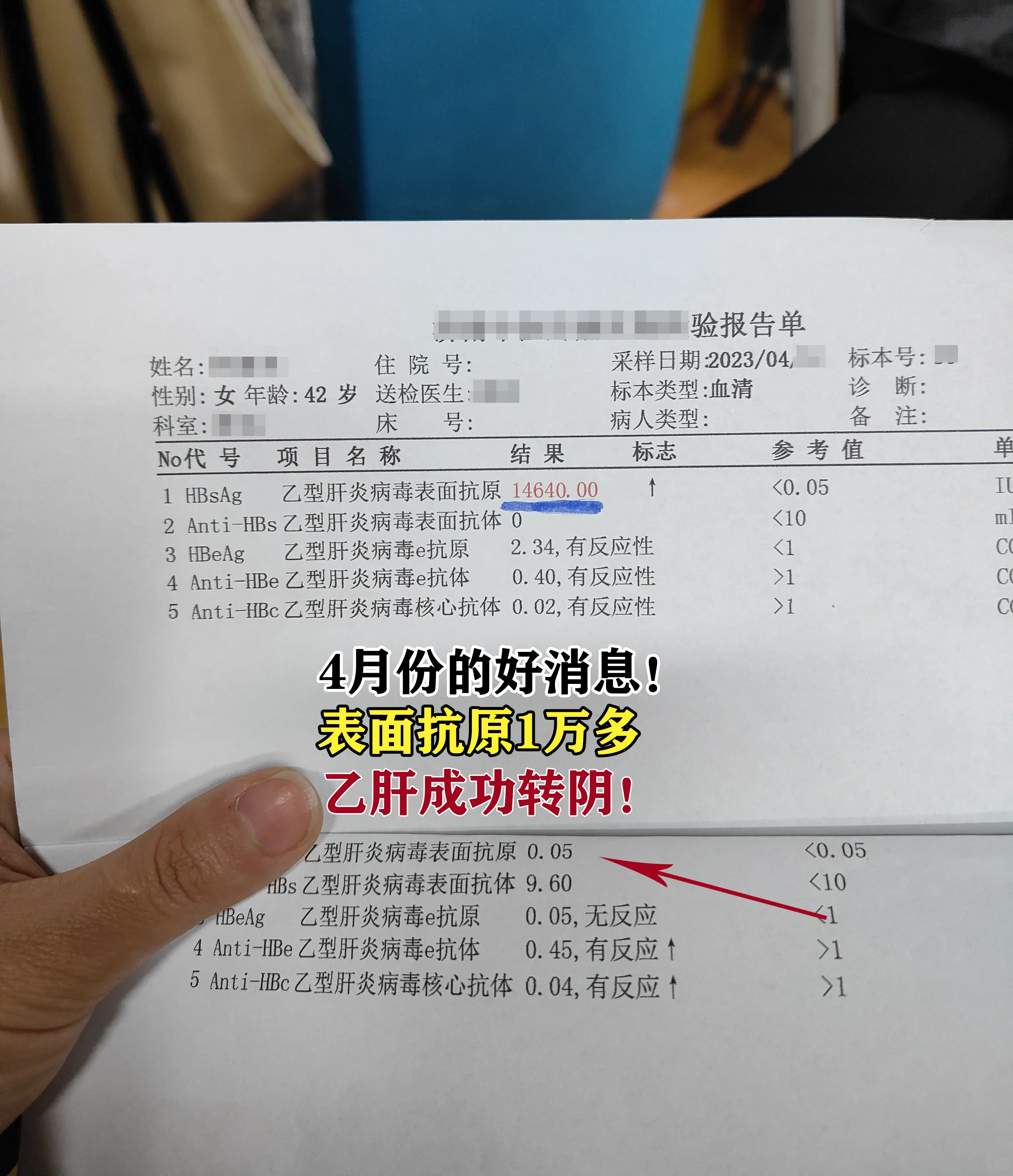 我没说错吧！不打干扰素也有机会转阴！。你当初来治疗的时候是个大三阳，表...