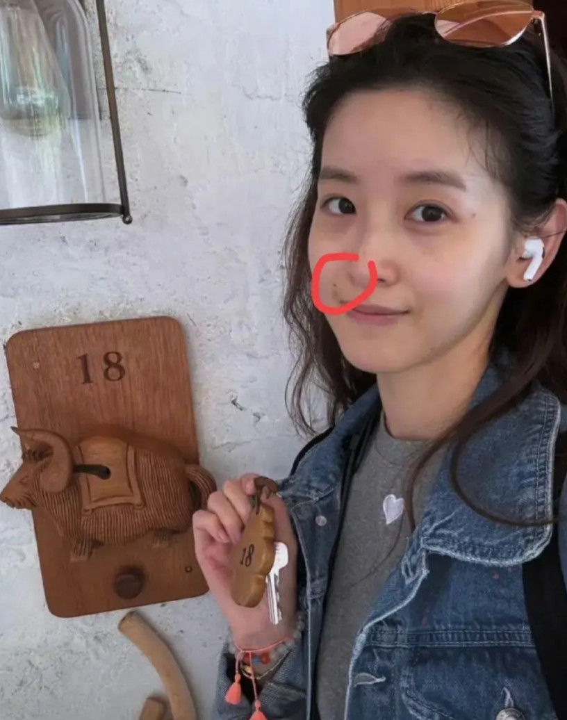 最近章泽天的照片一出来就给所有女生提了个醒你看她身为千亿富翁，脸上的痘痘