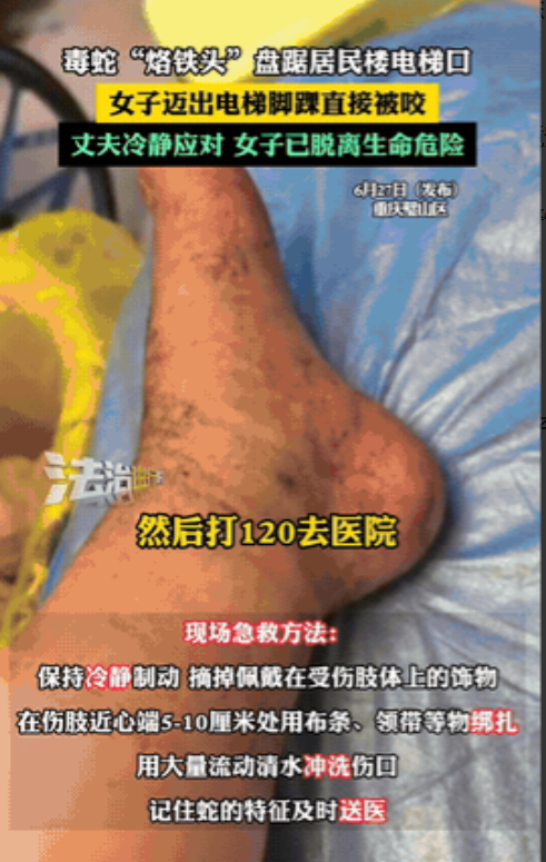 悲剧还是发生了！”重庆，一女子在小区里出电梯时，突然感到脚上一阵刺痛，她低头看了