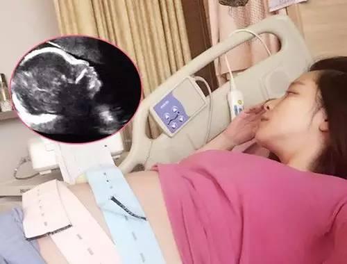 为什么有些孕妇需要一直卧床保胎?