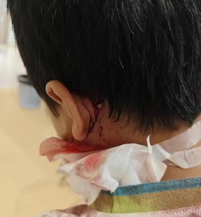 “严查到底！”江西南昌，9岁男孩去同学家串门，结果被拴在家中的狗扑倒撕咬，差一点