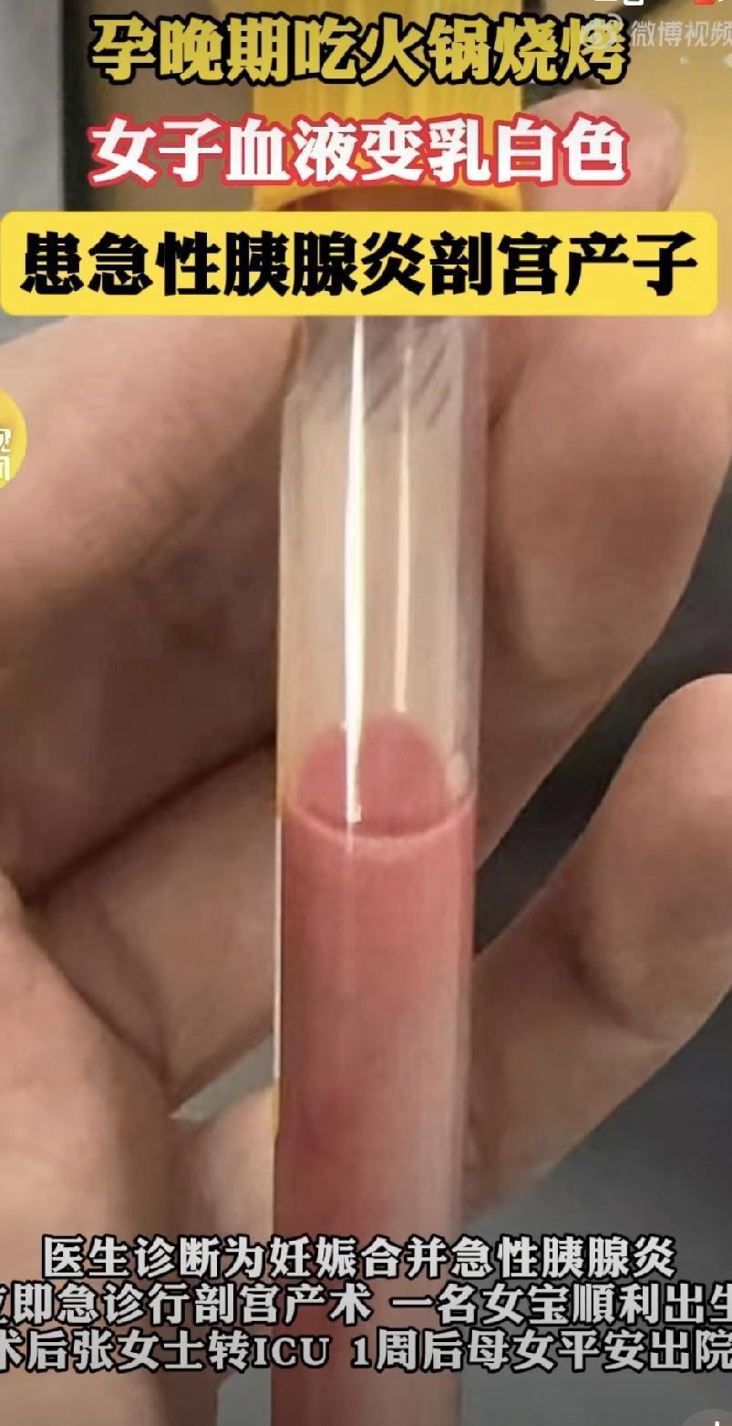 孕期吃喝真不能由着性子来！两位孕妈差点因为嘴馋出大事……看了新闻真吓人！西安