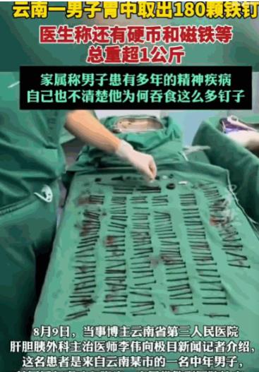 解释不清了！云南，一男子腹部剧痛送医，医生检查后当场被吓退三分：他体内居然塞满了