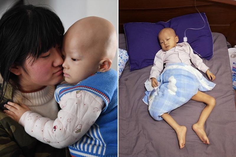 你觉得患癌后该不该倾家荡产治疗患癌后该不该倾家荡产治疗，这真是个扎心的问题。癌