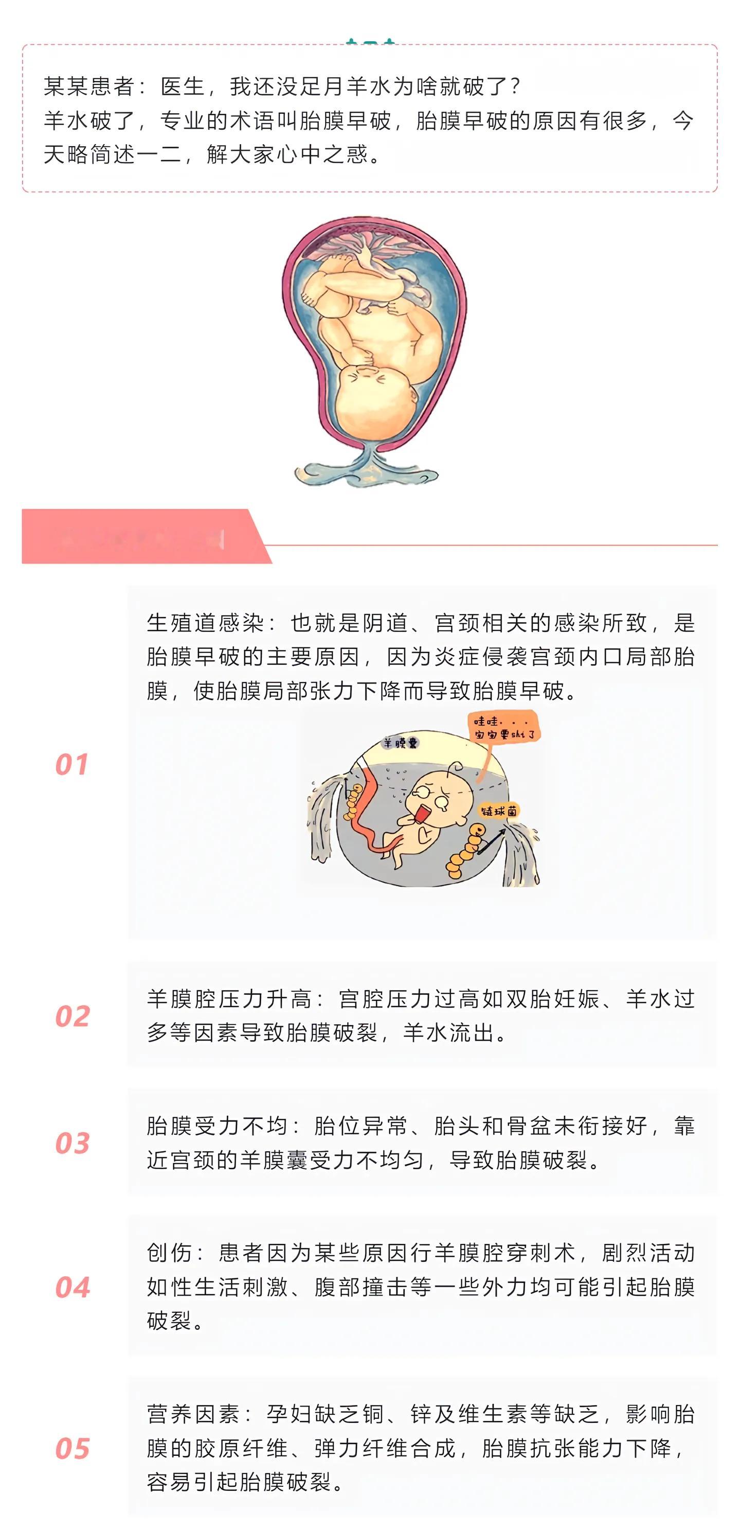 胎儿一脚踢破妈妈子宫致羊水流失未足月胎膜早破五大主因。胎儿踢破几乎不可能，连哪