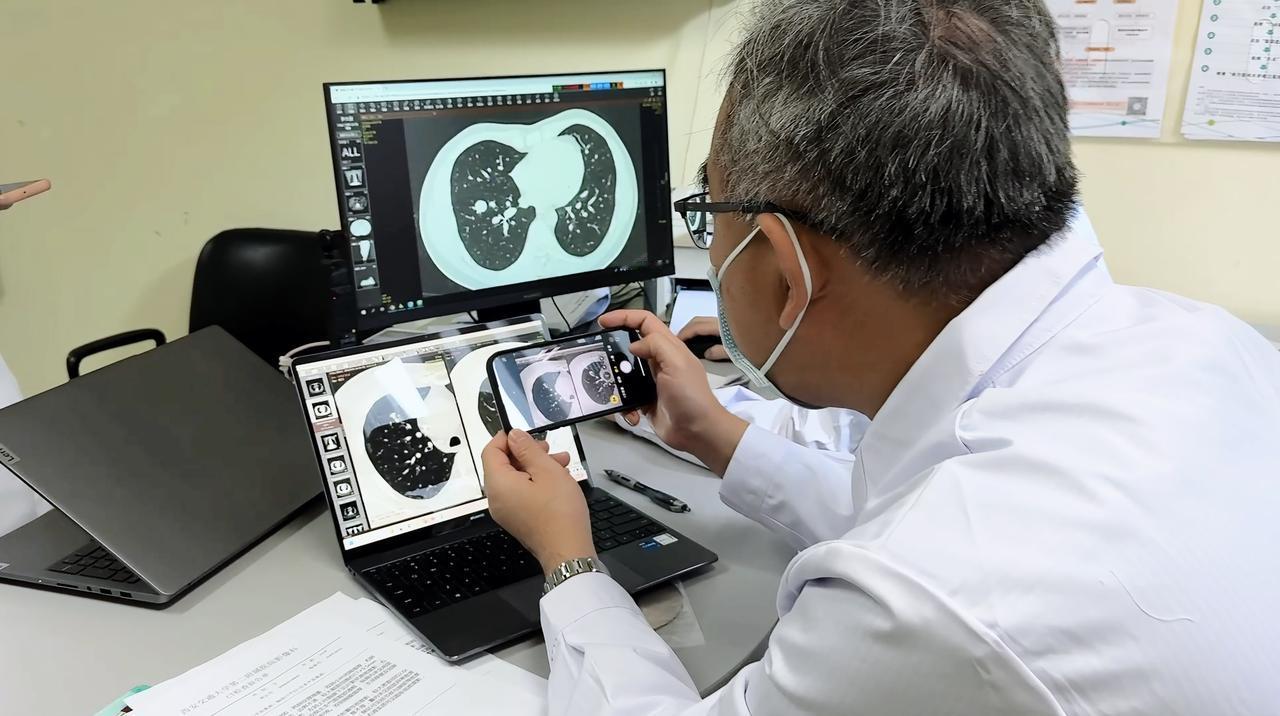在门诊中，我经常遇到患者拿着不同年份、不同医院的CT报告来咨询。比如，2023年