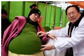 2009年，怀胎12个月的女人，在丈夫的陪同下挺着巨肚，来到了广州医院检查，没想