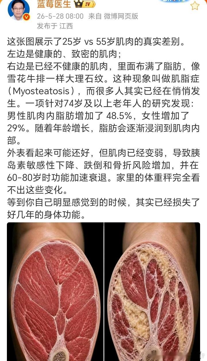 一项针对74岁及以上老年人的研究发现：男性肌肉内脂肪增加了48.5%，女性增加