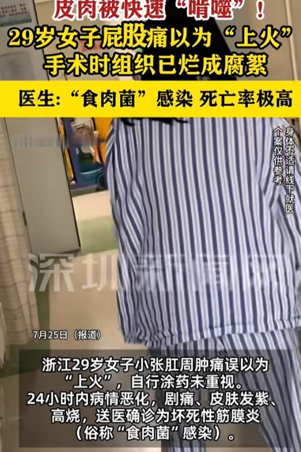 “悲剧还是发生了！”7月25日报道，浙江，一女子肛周肿痛，她以为是“上火”，涂了