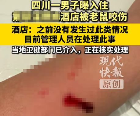 离了大谱！四川乐山，男子花几百块入住酒店，夜里在睡梦中被胳膊上一阵刺痛惊醒，开灯