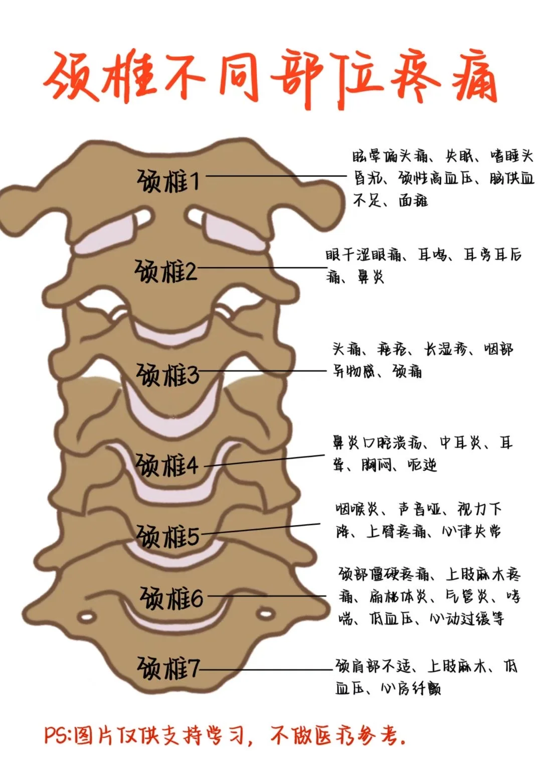 医学生笔记——颈椎不同疼痛位置
