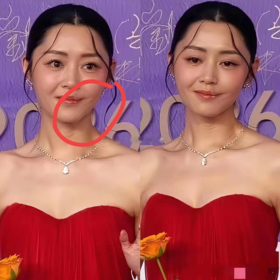 这都快破相了，牺牲太大了