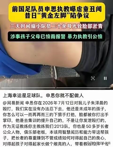 退役国脚坐上火山口，究竟是谁想跟申思过不去？这段时间，申思掌掴小球员的视频成了