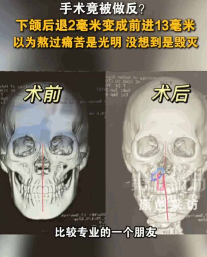24岁女孩躺上手术台本想做个微调，醒来却发现自己的脸彻底毁了，这不是恐怖电影的情