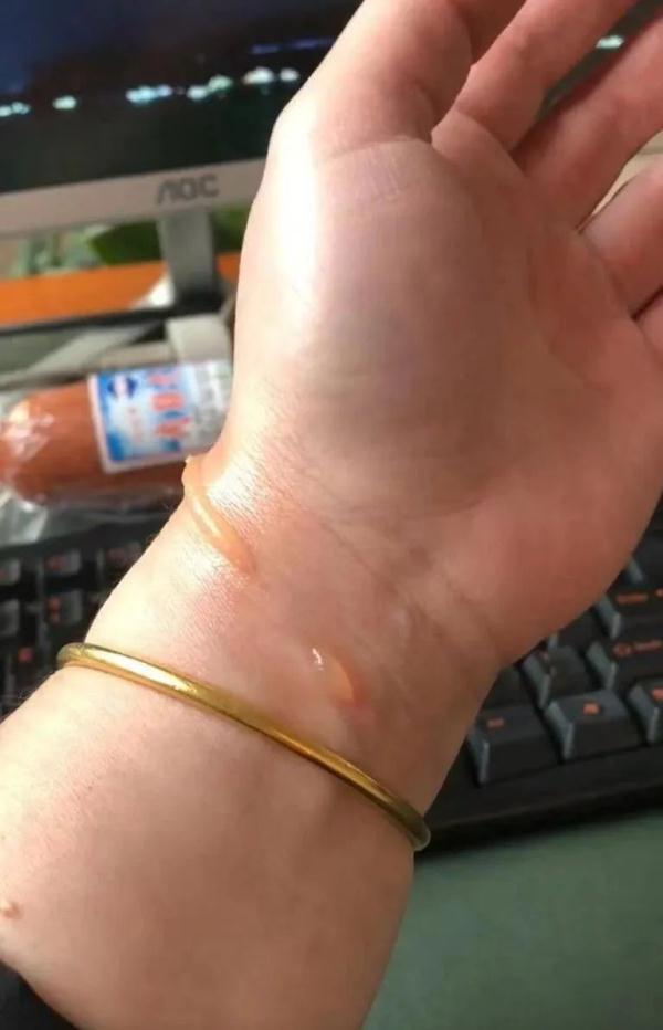 近日，有位大姐去医院做核磁共振，检查前她还挺细心的，把身上项链这些金属配饰全都摘