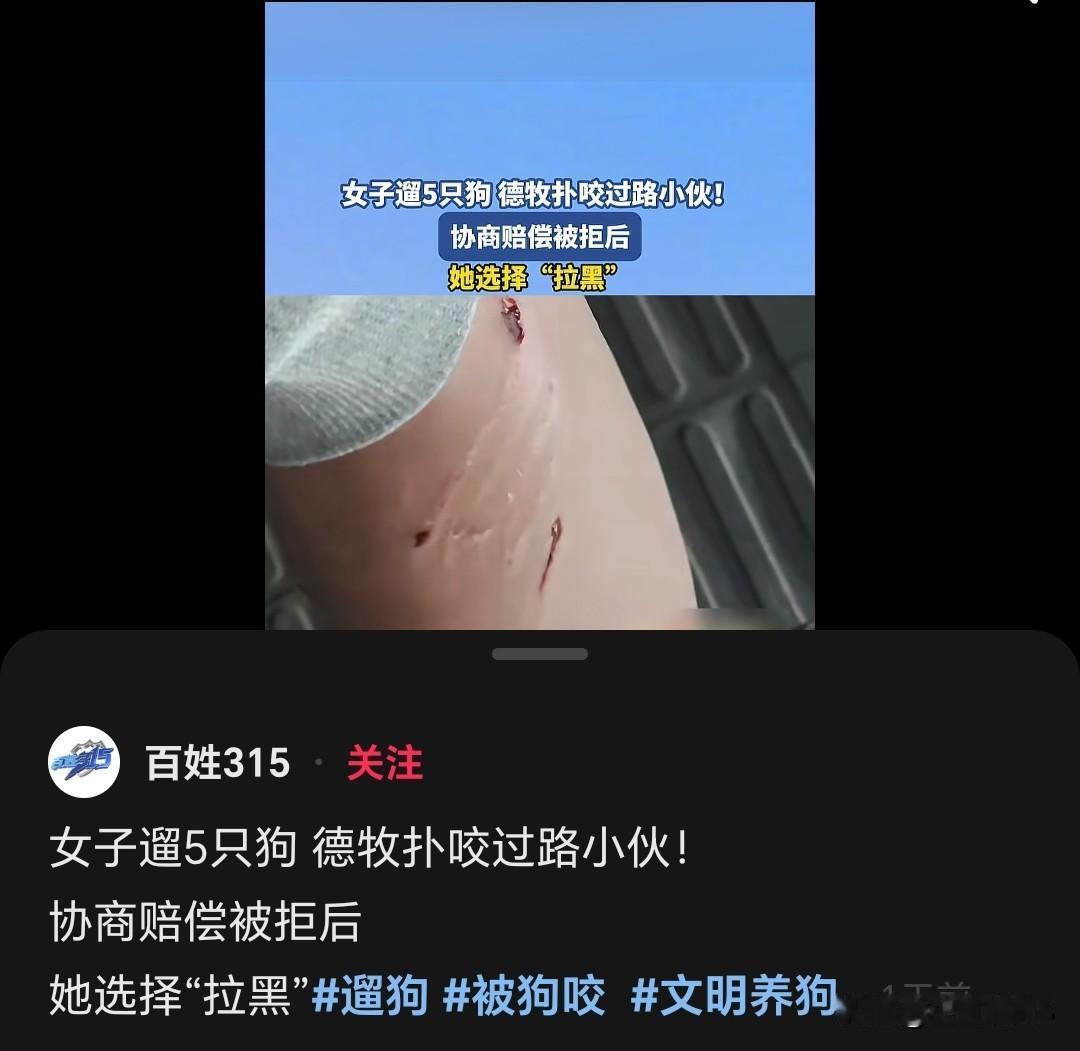 狗咬人事件，又看到新闻了，看这样咬的挺严重的，新闻里说，只愿意赔1000块钱，但