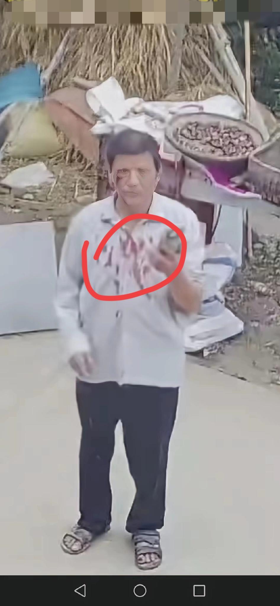 为了几只鸡，亲弟弟竟对64岁的亲大哥下死手，这哪是家人，简直比陌生人还狠心！