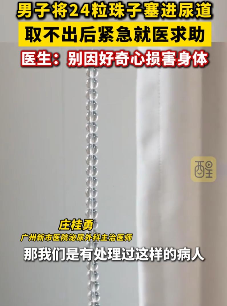好奇害死猫！广东广州，一男子忍不住好奇心，将24粒珠子塞进了尿道，可他很快就慌了