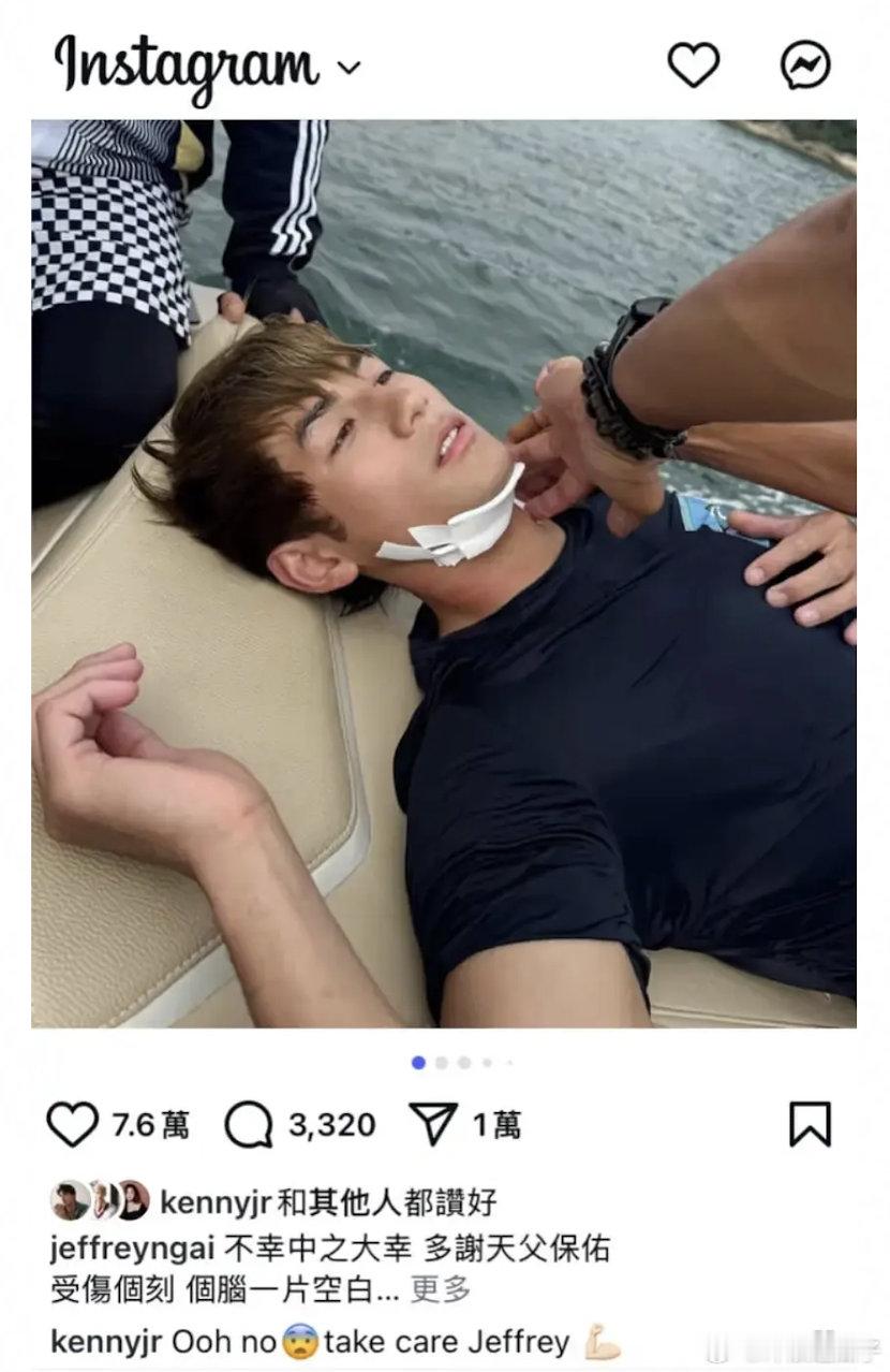 刷到一个香港艺人，演戏脖子被割了😱港圈拍戏都来真的吗？？？​​​
