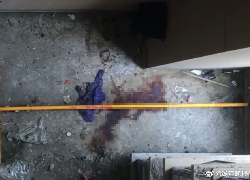 #双胞胎遭袭1死1伤姐姐手术欠几十万#【双胞胎姐妹遭妹妹男友伤害致1死1伤案，即