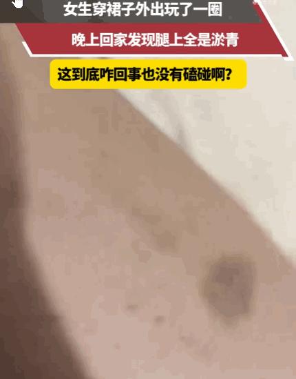 真是没想到！河南，一女生身穿裙子外出游玩，然而，当晚回到家后，她惊恐地发现自己双