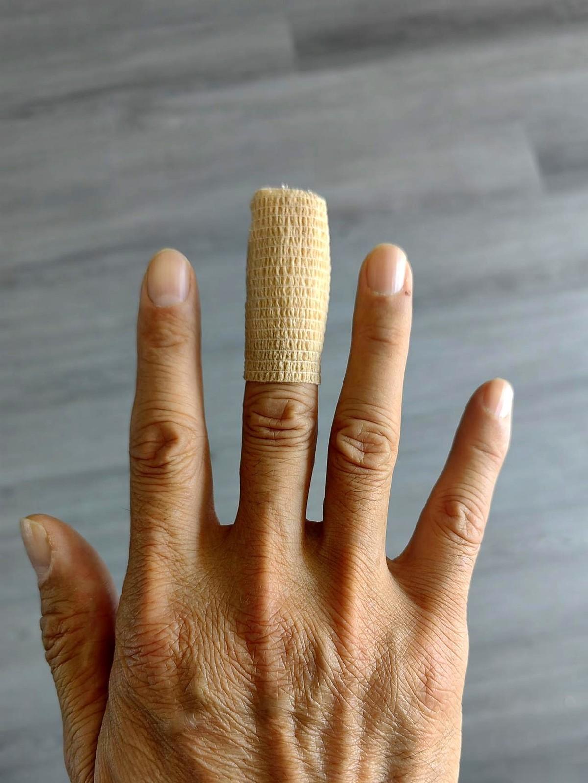 我捂着往外冒血的指头，一头冲进楼下诊所。想着几块钱，换个药，包一下就完事。护