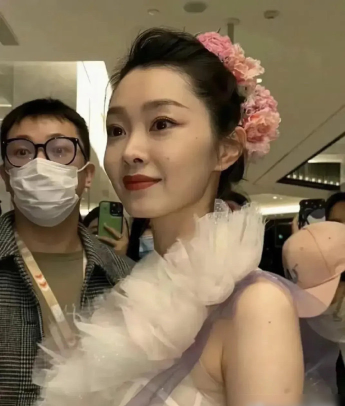 就算是皮肤白皙的明星，也有可能留下这样的疤痕，真是让人意想不到。