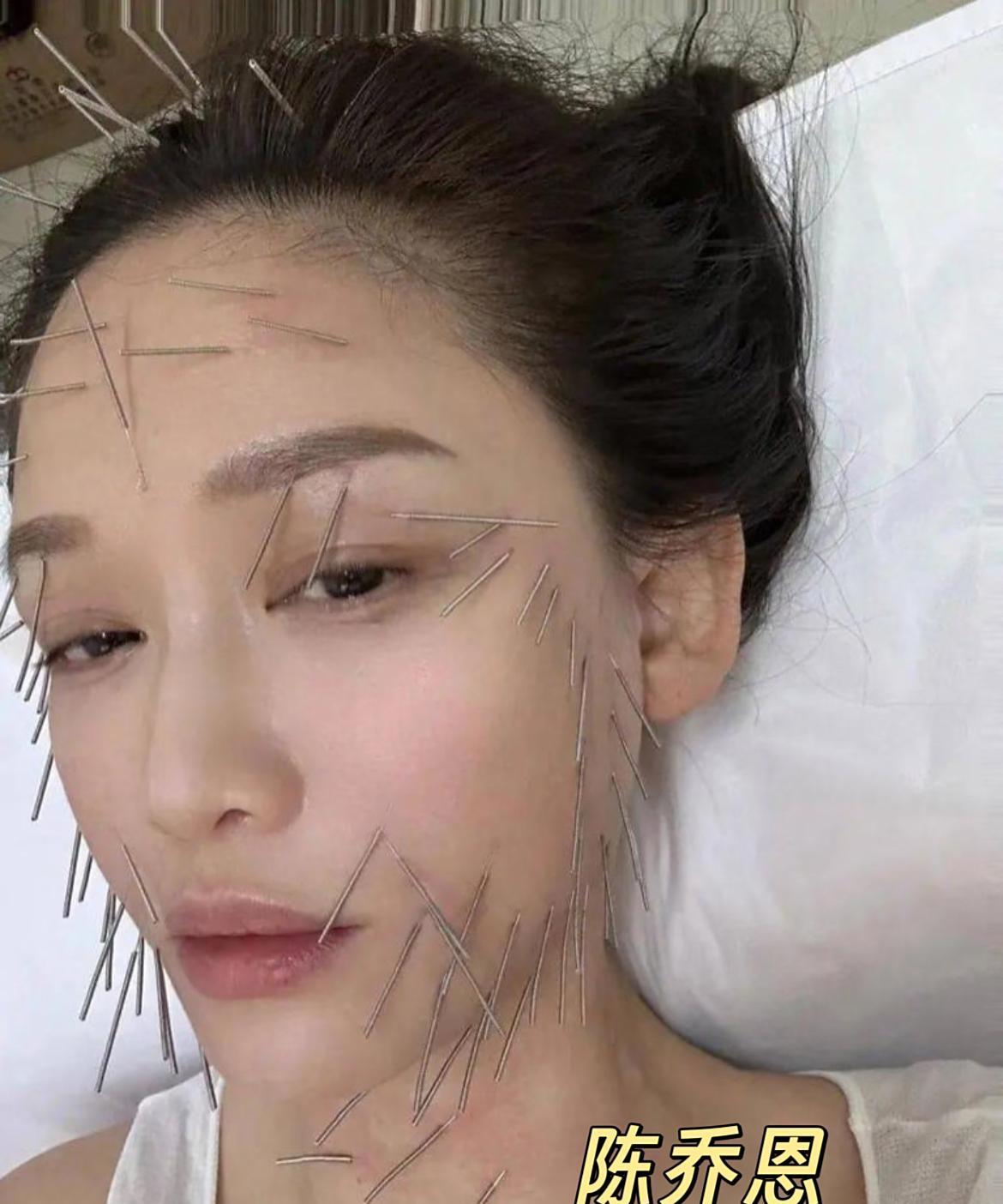 真是狠人，这看着都疼！陈乔恩曹格为了美也是拼了