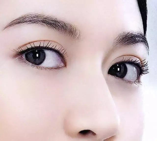 双眼皮术后恢复的快与慢