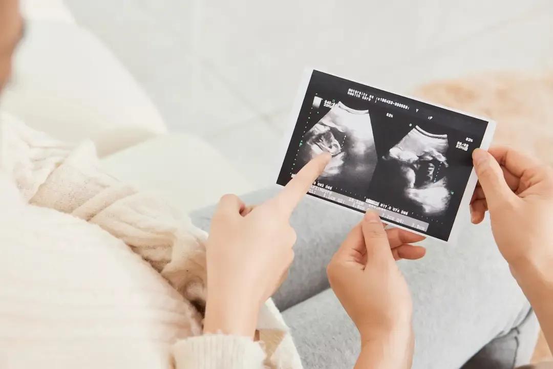 关于生男生女的民间传说:1、父身强者，头胎易生女孩；反之，母身强者，头胎易生男