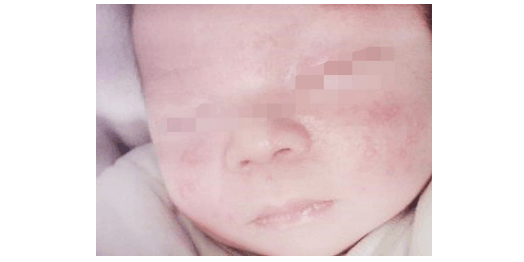 哺乳期的妈妈们, 这个水果只能看看, 不适用哺乳期的人