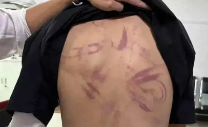 江西宜春惊现保安非法拘禁殴打未成年人，警方迅速介入！近日，江西宜春发生一起