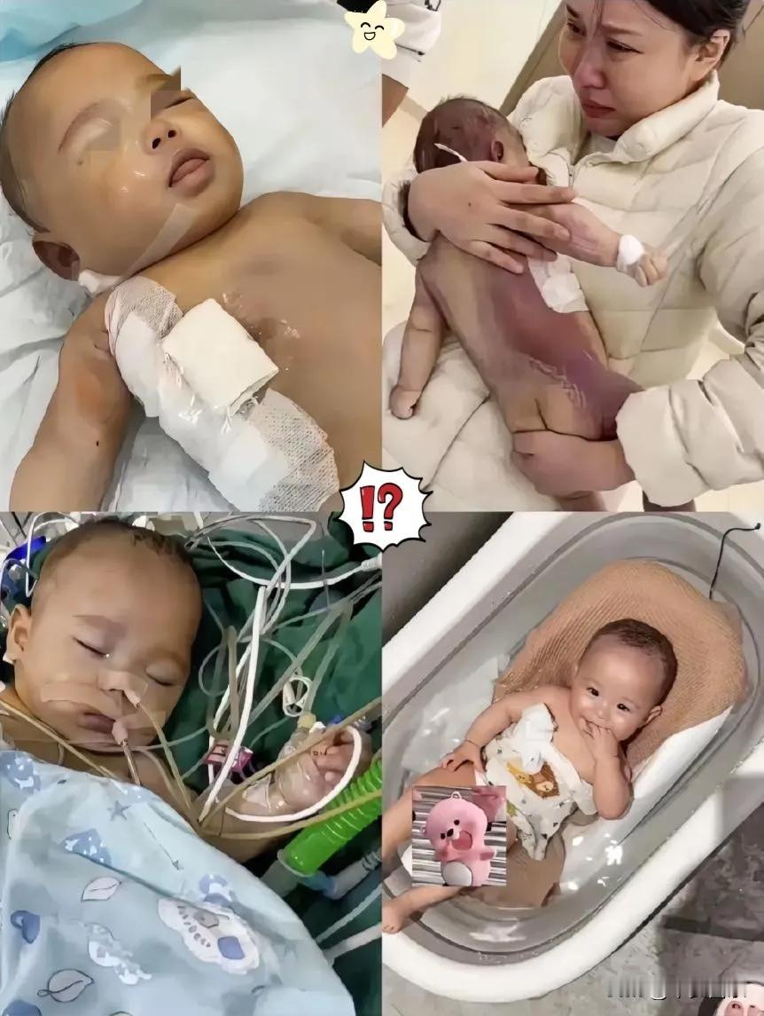 央视已出手调查！浙江五个月大的宝宝，原计划两小时完成的微创手术，实际进行了