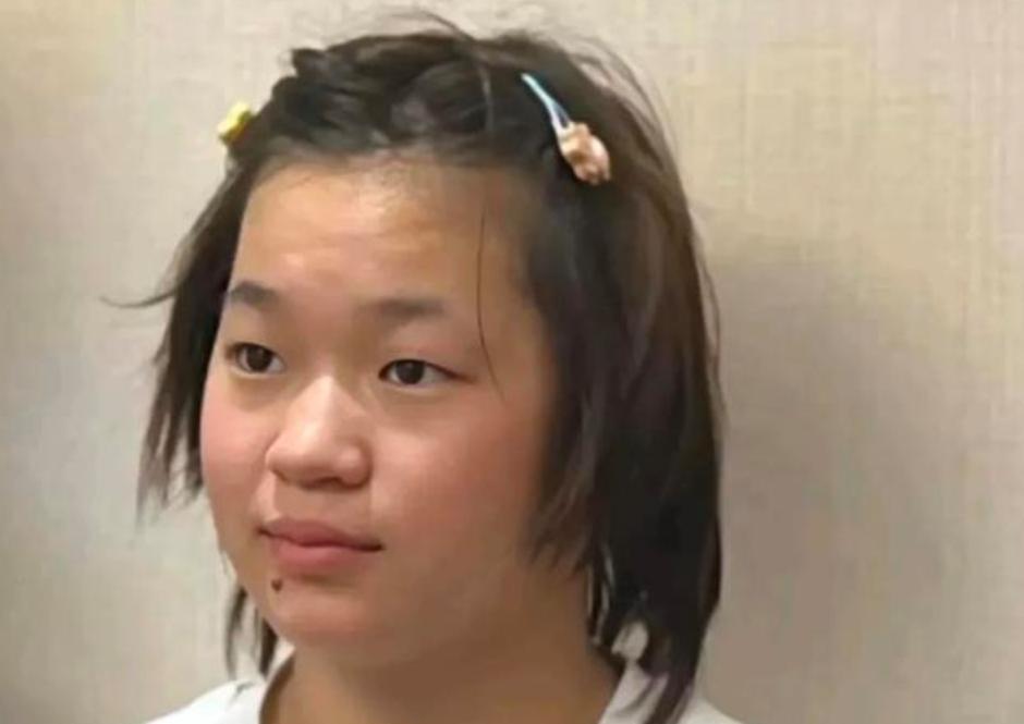 全红婵居然长这样了，奥运三金得主大变样，身材发福明显。正在养伤的她从近照看，肉