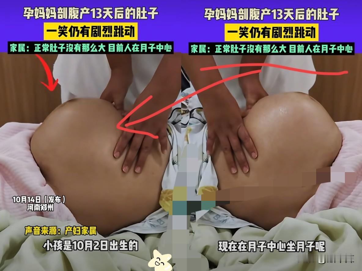“太离谱了！”10月14日，河南郑州，一位宝妈生完孩子10天后，肚子非但没有消下