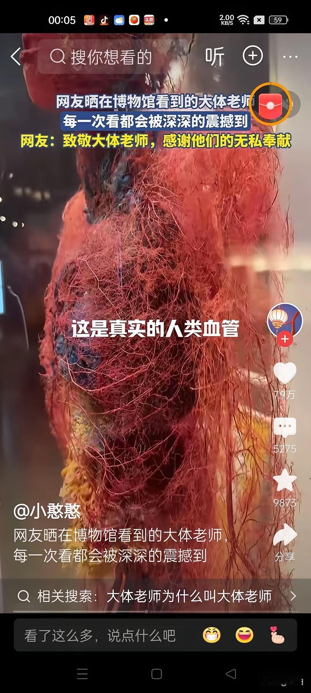 大体博物馆争议：疼吗？自愿吗？疼吗？看着真揪心。大体老师被展示，这样真的