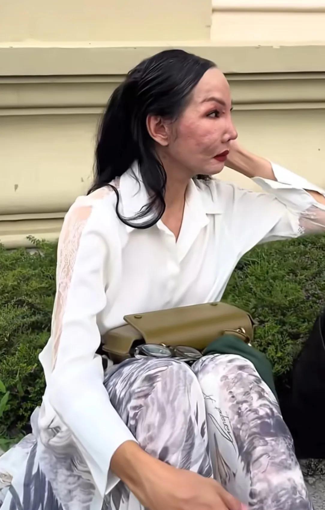 整容有风险，动脸需谨慎！