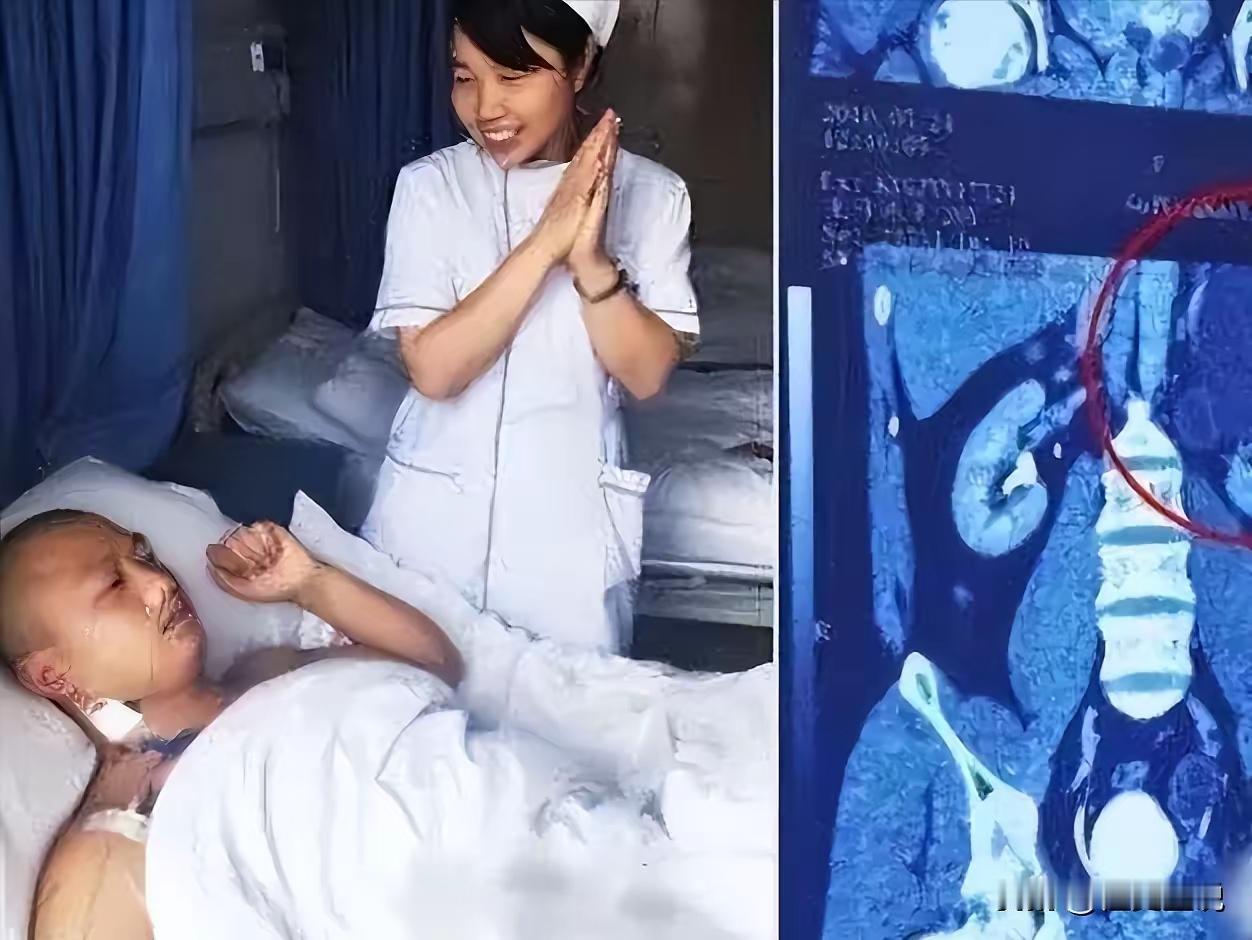 我的丈夫有4个肾！”2016年，贵州一男子天生神力，可以把白酒当水喝，除此之外，