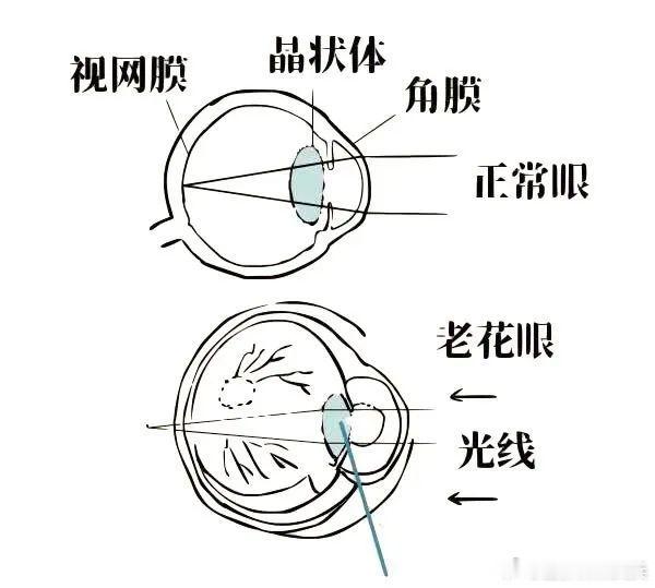 如何避坑轻松选到护眼神器66爱眼日健闻登顶计划缺乏哪些营养素会影响眼睛健康