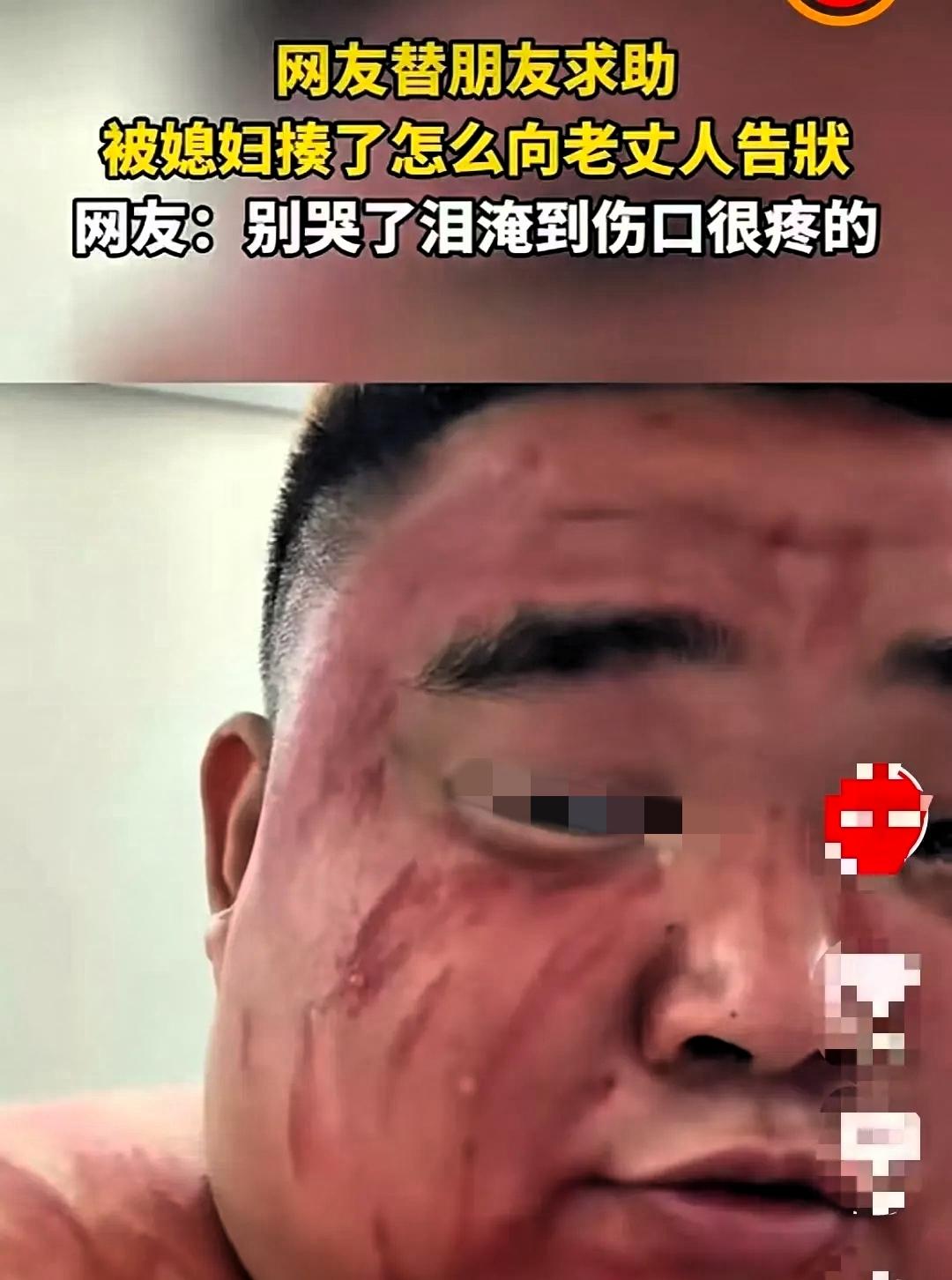 湖北，一男子被媳妇打了，躲到朋友家哭诉，说要去老丈人那告状。谁知，他一连蹲了两天