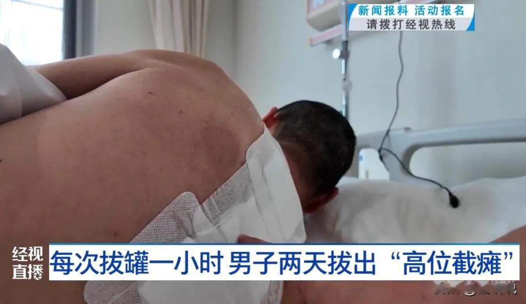 武汉男子自诊湿气重拔罐致高位截瘫武汉陈先生长期腰背疼，未就医反认为是湿气重，网