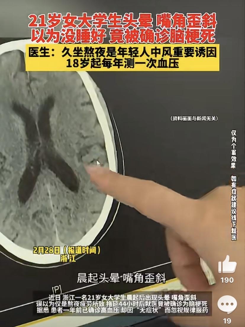 最近有个让人特别揪心的新闻，一位二十出头的学生，早上起来头晕、嘴角有点歪，一开始