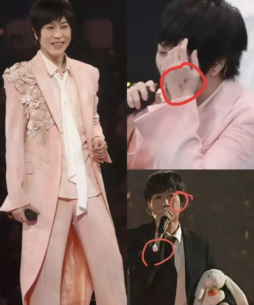 全国演出事故降了12%，但37%的艺人还在往下掉。阿信从1.2米高台踩空。