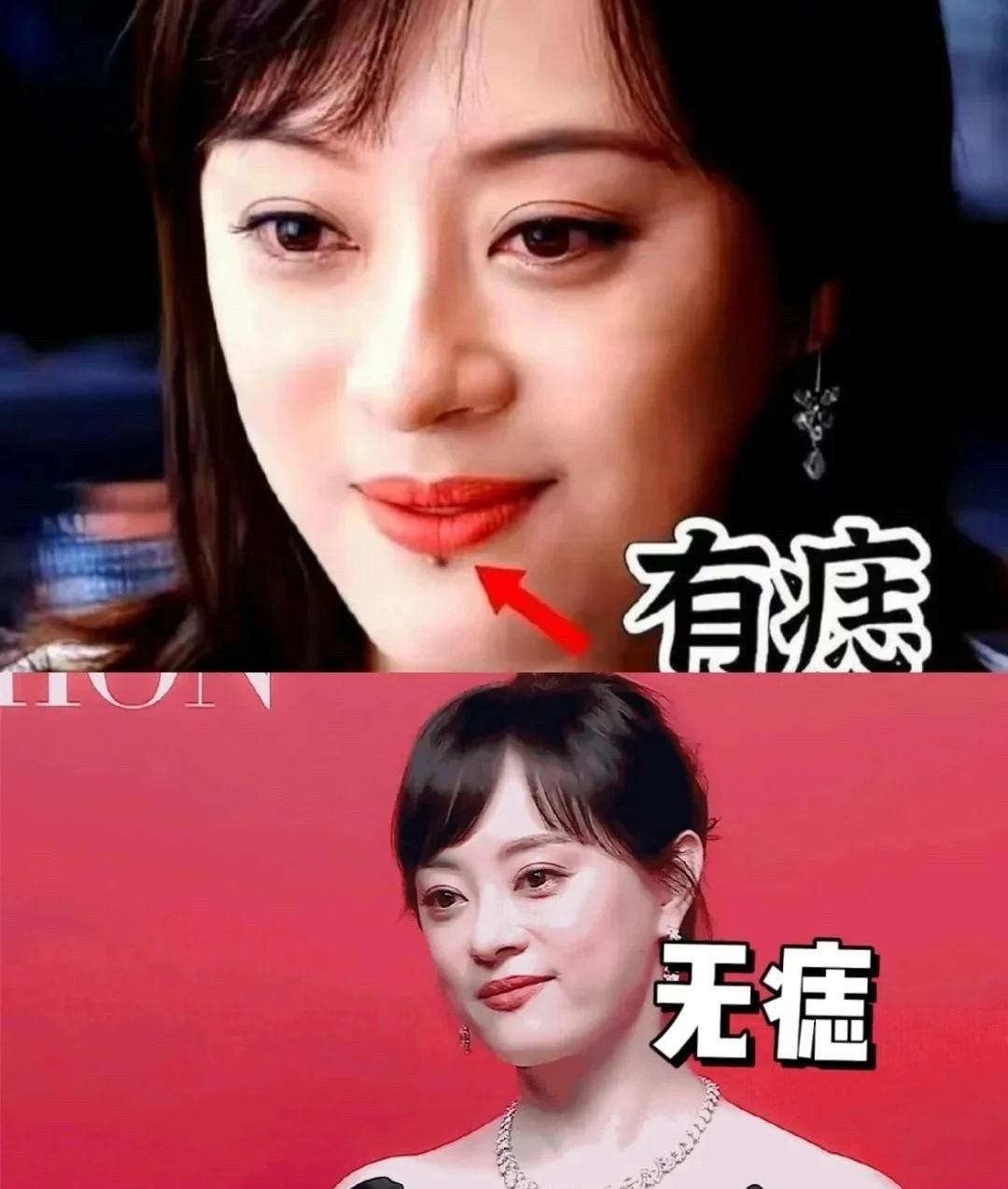 孙俪可能没有意识到，她把唇下痣切了之后，将会面临什么，毕竟——中年得“痣”