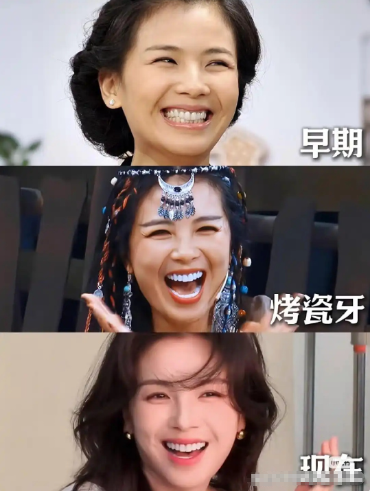 据说刘涛这一口牙花了三百万，值不值？​​​