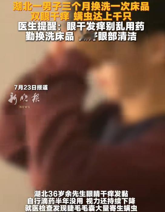 35岁的余先生，这半年来每天早上睁开眼，都感觉眼皮被什么东西黏住了。又干又痒，分