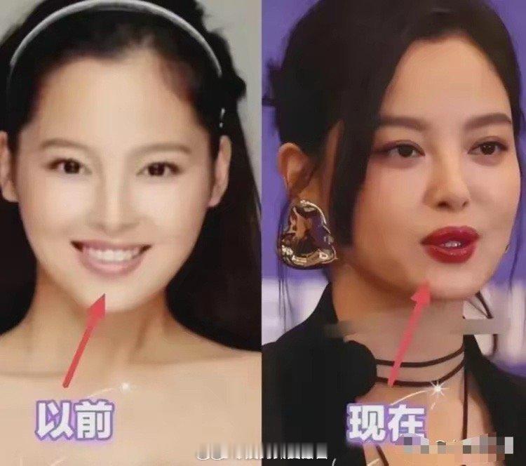 辛芷蕾的嘴唇，10年前长这样，是什么原因让薄唇变
